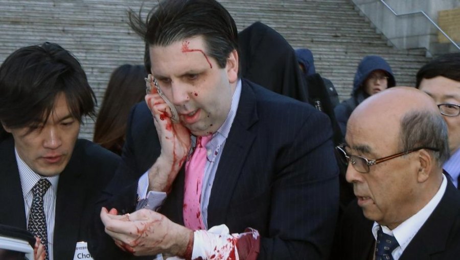 El embajador de EEUU en Corea del Sur herido tras ser atacado en Seúl