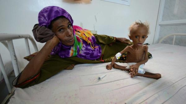 La impactante imagen de un niño que retrata el drama de la guerra en Yemen
