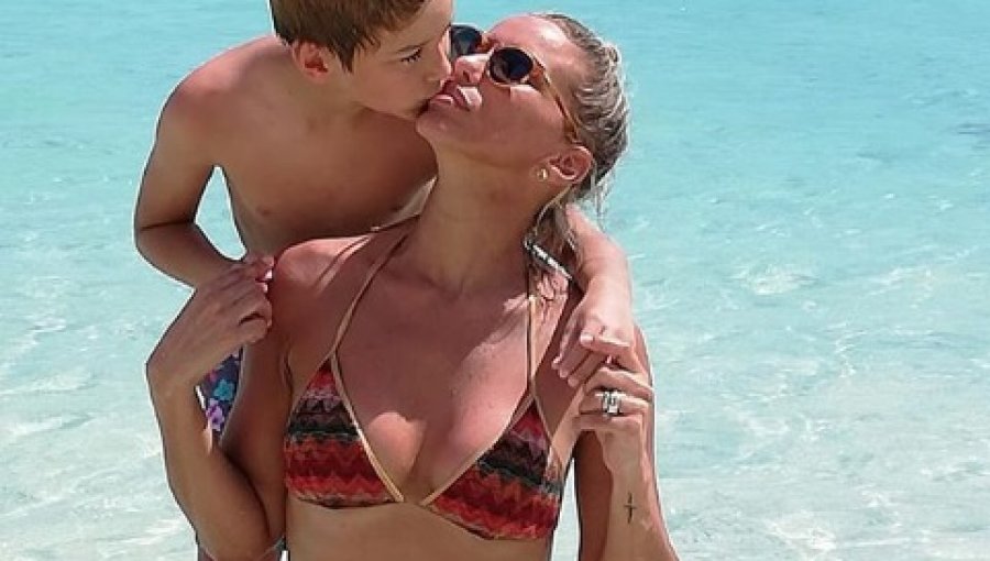 Claudia Schmitd sorprende con foto en bikini tras lipoescultura abdominal