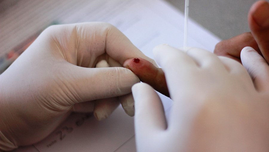 Instituto de Salud Pública confirmó cerca de 2 mil nuevos casos de VIH en primer trimestre
