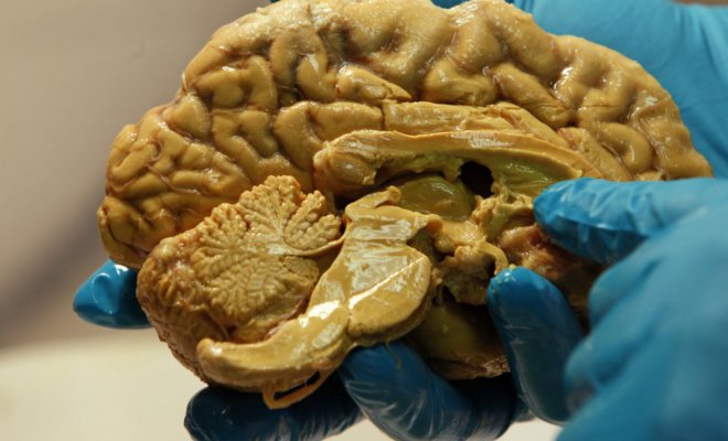 Fin al misterio: Investigación descartó presencia de "ameba come cerebros" en planta de Olmué
