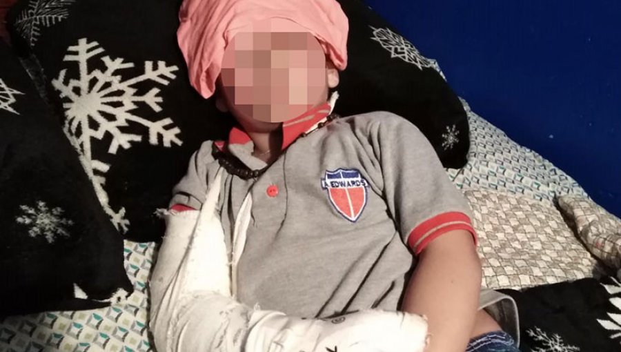 Madre de escolar acusa que profesor de colegio porteño lo dejó con serias lesiones