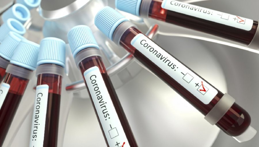 Intendencia confirma nuevo caso de coronavirus en la región de Magallanes