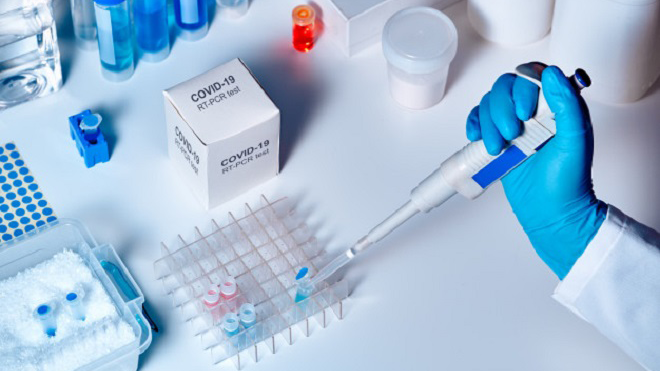 Clínicas de la región Metropolitana suspenden tomas de exámenes PCR por falta de stock