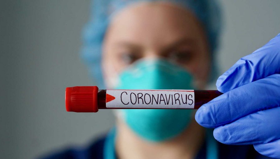 2.659 son los casos nuevos diagnosticados con coronavirus Covid-19 en Chile