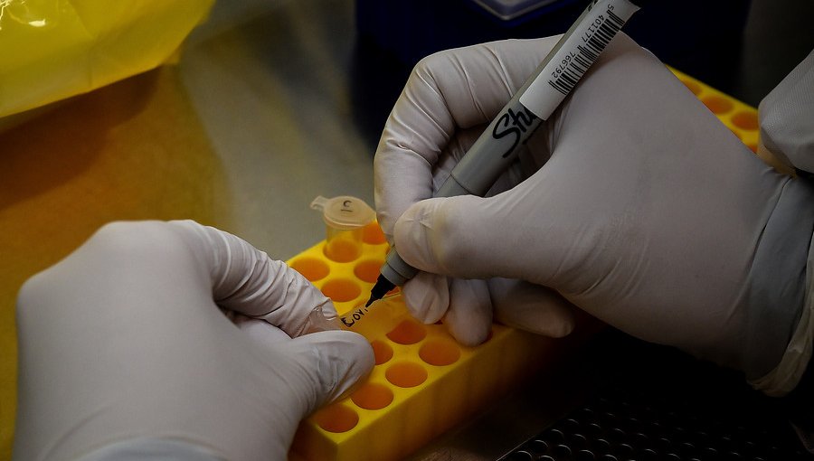 Ministerio de Salud suspende permisos a cinco laboratorios por errores en resultados de test por coronavirus