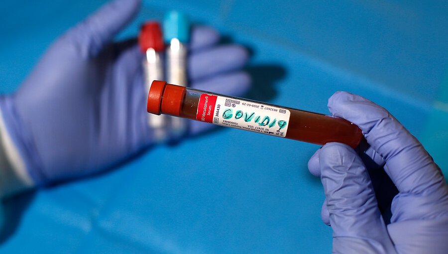 4.207 casos nuevos elevan cifra de contagiados con coronavirus a 122.499 personas
