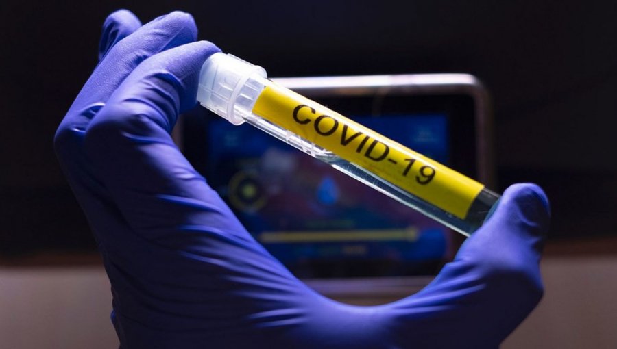 5.737 casos nuevos elevan a 148.496 la cifra de contagiados con Covid-19 en Chile