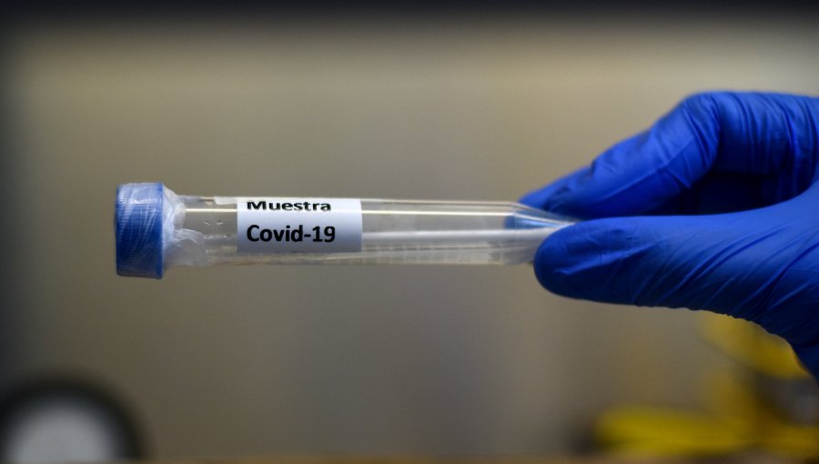Covid-19: La pandemia ha dejado casi un millón de muertos en el mundo